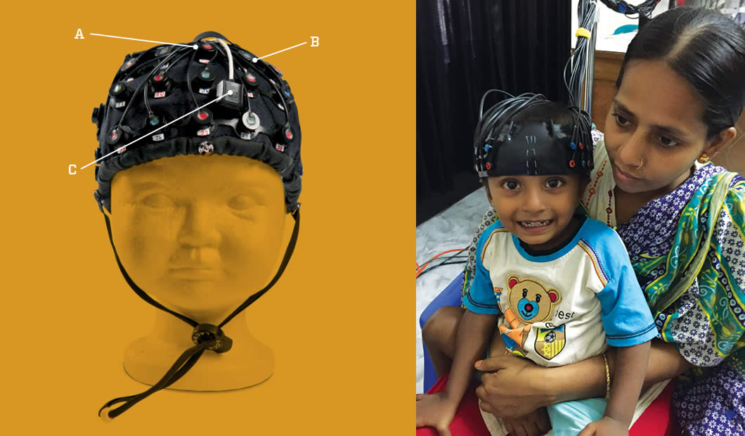 This functional near infrared spectroscopy (NIRS) cap is designed for infant brain measurement. The optical fibers are arranged in an alternating pattern of source fibers (A) and detector fibers (B) on the forehead over the prefrontal cortex. An accelerometer (C) records infant motion during an experiment. The fibers can also be positioned over the ears to measure the temporal cortex.